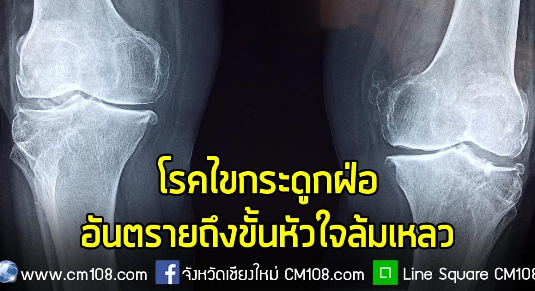 Banner-bone-02-08-2562