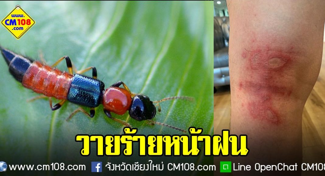 Banner-bug-09-10-2562