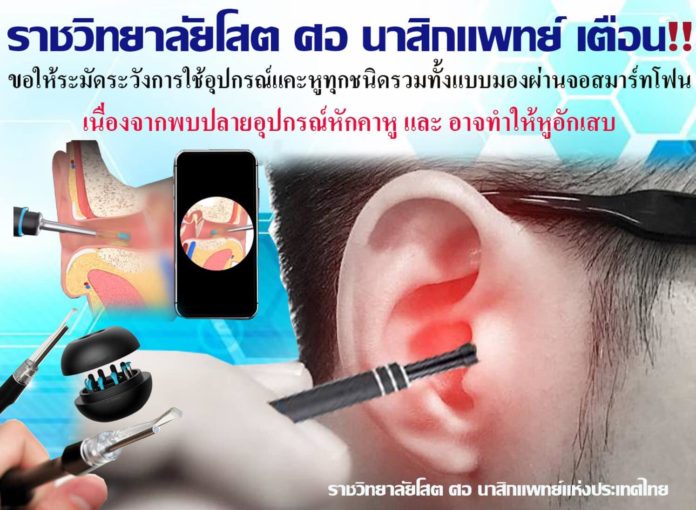 เตือน!! อันตรายจากการ ใช้อุปกรณ์แคะหู เสี่ยงหูอักเสบ และอุปกรณ์หลุดหักอยู่ในช่องหู