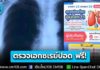 ผู้ประกันตน ม.33, 39 ตรวจเอกซเรย์ปอด ฟรี! ทุก 3 ปี 6 กลุ่มเสี่ยงควรตรวจเป็นพิเศษ