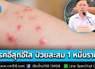 กรมควบคุมโรค เผย “โรคอีสุกอีใส” พบผู้ป่วยเพิ่มช่วงต้นปี ป่วยสะสมกว่า 1 หมื่นราย โดยเฉพาะในกลุ่มเด็กเล็กและเด็กวัยเรียน