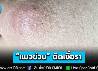 เหล่าทาสต้องระวัง! หมอมนูญเผยเคสผู้ป่วยถูก “แมวข่วน” เป็นตุ่มนูนไม่ยุบ ตรวจเจอเชื้อรากินยานาน 6 เดือนจนกว่าแผลจะหาย