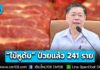 “ไข้หูดับ” ป่วยแล้ว 241 ราย แนวโน้มเพิ่มช่วงอากาศร้อน แนะเลี่ยงอาหารสุกๆ ดิบๆ ป้องกันหูหนวกถาวร เสียชีวิต