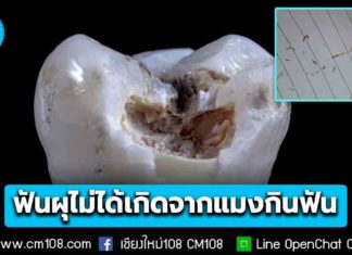 หมอย้ำ! ฟันผุ ไม่ได้เกิดจาก “แมงกินฟัน” แต่เกิดจากเชื้อแบคทีเรีย