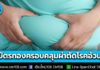 “บัตรทอง 30 บาท” ครอบคลุมบริการ “ผ่าตัดโรคอ้วน” สำหรับผู้ป่วยที่มีภาวะอ้วนรุนแรงและเข้าเกณฑ์ตามข้อบ่งชี้ทางการแพทย์ ย้ำไม่ใช่เพื่อความสวยงาม แต่เพื่อสุขภาพที่ดี