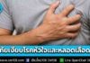 กรมควบคุมโรค เตือน “โรคหัวใจและหลอดเลือด” ภัยเงียบอันดับ 1 ระวังปัจจัยเสี่ยง แนะวิธีป้องกัน ออกกำลังกาย-งดดื่มเหล้า-ตรวจสุขภาพ-กินของมีประโยชน์