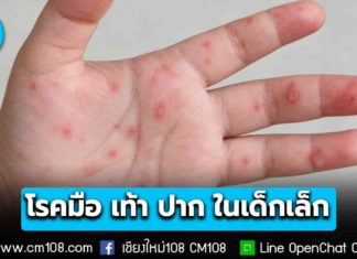 กรมควบคุมโรค เตือน “โรคมือ เท้า ปาก” ในเด็กเล็ก ป่วยเพิ่มขึ้นช่วงฤดูฝน-เปิดเทอม ปี 69 ป่วยสะสม 5.3 หมื่นราย แนะสถานศึกษาคัดกรองเข้ม ผู้ปกครองหมั่นสังเกตอาการ