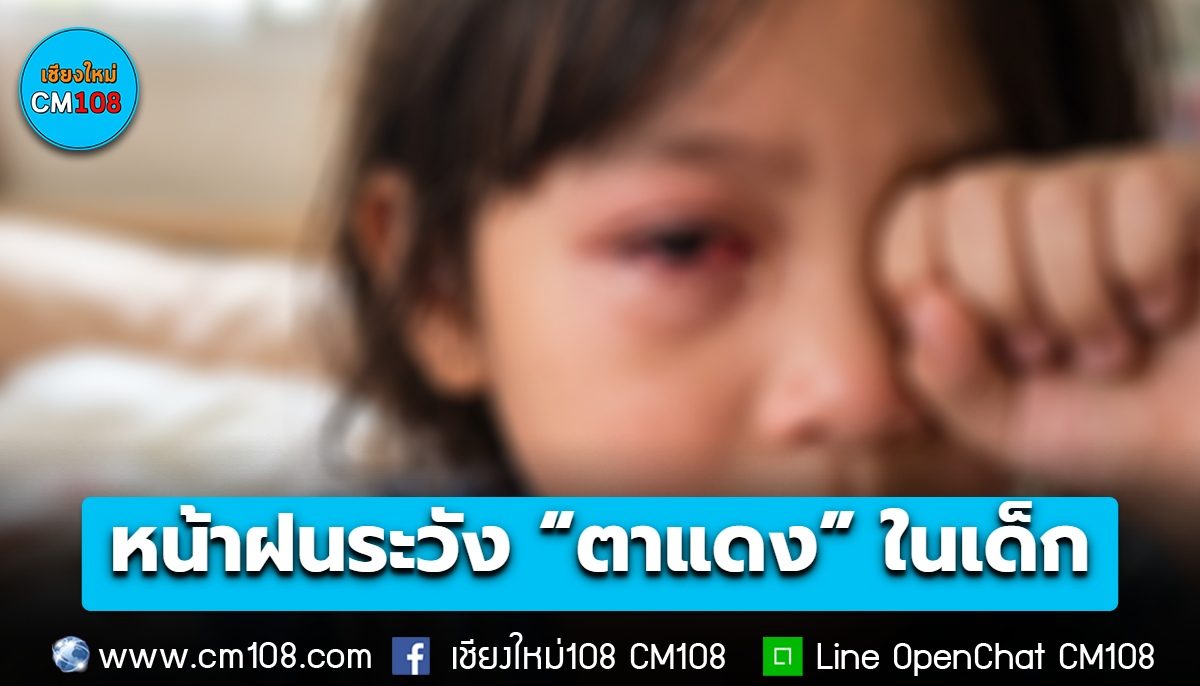 เตือน! ผู้ปกครอง หน้าฝนระวัง “ตาแดง” ในเด็ก แพร่เชื้อผ่านการสัมผัสน้ำตา ใช้ของร่วมกัน